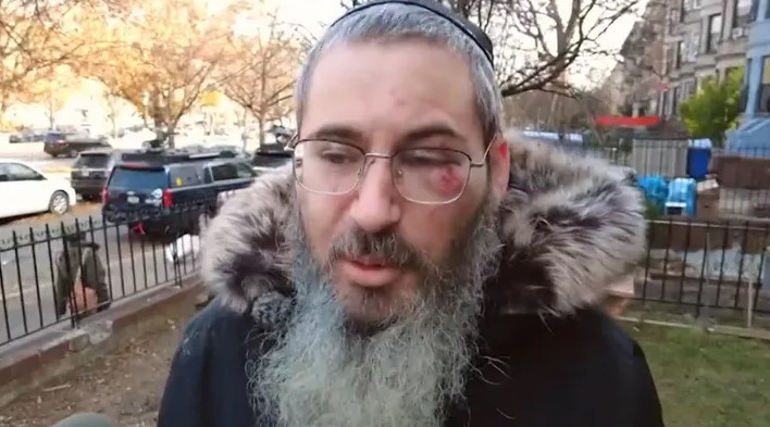 Antisemitischer Überfall in Brooklyn: Jüdischer Mann am 1 Chanukka-Tag brutal angegriffen